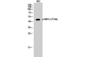 Western Blotting (WB) image for anti-Mitogen-Activated Protein Kinase Kinase 2 (MAP2K2) (pThr394) antibody (ABIN3182068)