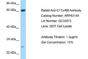 Western Blotting (WB) image for anti-Chromosome 17 Open Reading Frame 66 (C17orf66) (C-Term) antibody (ABIN2789392) (C17orf66 Antikörper  (C-Term))