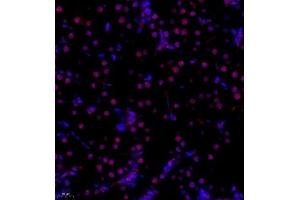 Immunofluorescence (Paraffin-embedded Sections) (IF (p)) image for anti-RNA Binding Motif Protein 45 (RBM45) antibody (ABIN7075477)