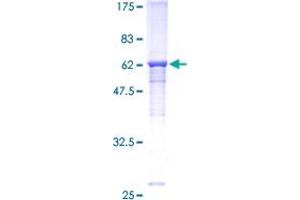 Image no. 1 for Carcinoembryonic Antigen-Related Cell Adhesion Molecule 6 (CEACAM6) (AA 1-344) protein (GST tag) (ABIN1349077) (CEACAM6 Protein (AA 1-344) (GST tag))