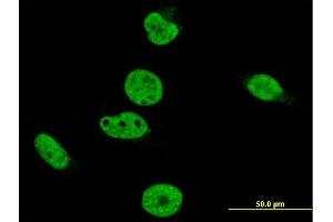 Immunofluorescence of monoclonal antibody to CRKRS on HeLa cell. (CDK12 Antikörper  (AA 1281-1380))