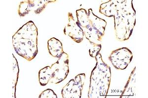 IHC analysis of RPL11 using anti-RPL11 antibody (ABIN7602315).