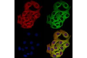 ABIN7094511 and ABIN7098560 staining Hela cells by IF/ICC. (SNAP23 Antikörper  (Internal Region))
