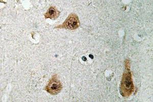Immunohistochemistry (IHC) analyzes of Annecin I antibody in paraffin-embedded human brain tissue. (Annexin a1 Antikörper)