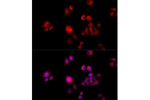 Immunofluorescence analysis of HeLa cells using GLUD2 antibody (ABIN5973969) at dilution of 1/100 (40x lens). (GLUD2 Antikörper)