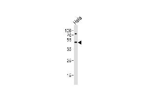 Western Blotting (WB) image for anti-Vacuolar Protein Sorting-Associated Protein 4A (VPS4A) (AA 44-77), (N-Term) antibody (ABIN6243379)