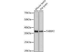 Western blot analysis of extracts of various cell lines, using T Rabbit mAb (ABIN7270729) at 1:1000 dilution. (TARBP2 Antikörper)