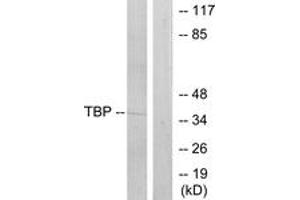 Western blot analysis of extracts from 293 cells, using TBP Antibody. (TBP Antikörper  (AA 151-200))
