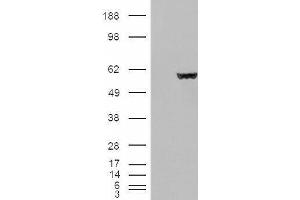 HEK293 overexpressing Fumarase (ABIN5498812) and probed with ABIN190758 (mock transfection in first lane).