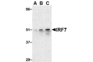 Image no. 1 for anti-Interferon Regulatory Factor 7 (IRF7) (C-Term) antibody (ABIN265129) (IRF7 Antikörper  (C-Term))
