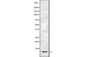 Western blot analysis of CCL23 expression in HEK293 cells ,The lane on the left is treated with the antigen-specific peptide. (CCL23 Antikörper)