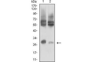 Western blot analysis using CD215 mouse mAb against LOVO (1) and HCT116 (2) cell lysate. (IL15RA Antikörper  (AA 31-205))