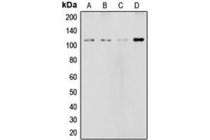 Western blot analysis of NOTCH2 expression in HeLa (A), MCF7 (B), rat liver (C), NIH3T3 (D) whole cell lysates. (NOTCH2 Antikörper  (Center))