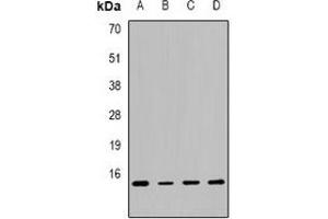 Western blot analysis of Calcitonin expression in MCF7 (A), SW480 (B), mouse lung (C), mouse liver (D) whole cell lysates. (Calcitonin Antikörper  (C-Term))