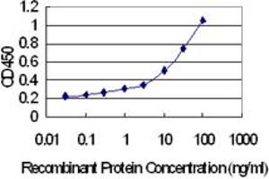 anti-Solute Carrier Family 22 (Organic Cation Transporter), Member 18 Antisense (SLC22A18AS) (AA 1-150) antibody