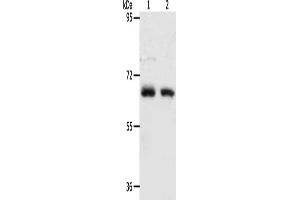 Gel: 8 % SDS-PAGE, Lysate: 40 μg, Lane 1-2: Human fetal kidney tissue, Human fetal lung tissue, Primary antibody: ABIN7128162(ACOT11 Antibody) at dilution 1/450, Secondary antibody: Goat anti rabbit IgG at 1/8000 dilution, Exposure time: 90 seconds (ACOT11 Antikörper)