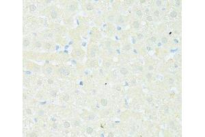 Immunohistochemistry of paraffin-embedded Rat liver using TRIM15 Polyclonal Antibody at dilution of 1:100 (40x lens). (TRIM15 Antikörper)