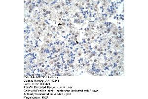 Rabbit Anti-SF3B1 Antibody  Paraffin Embedded Tissue: Human Liver Cellular Data: Hepatocytes Antibody Concentration: 4. (SF3B1 Antikörper  (Middle Region))