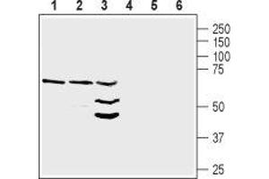 Western blot analysis of rat heart lysate (lanes 1 and 4), mouse heart membranes (lanes 2 and 5) and mouse brain lysate (lanes 3 and 6): - 1-3. (Neuregulin 1 Antikörper  (Extracellular, N-Term))
