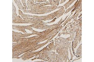 IHC analysis of LPP using anti-LPP antibody (ABIN7599606). (LPP Antikörper  (AA 10-572))