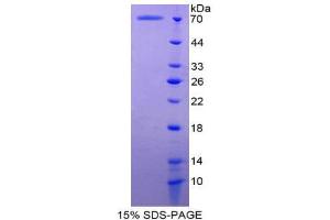 SDS-PAGE (SDS) image for Inhibin, beta B (INHBB) (AA 50-404) protein (His tag,GST tag) (ABIN2123007) (INHBB Protein (AA 50-404) (His tag,GST tag))