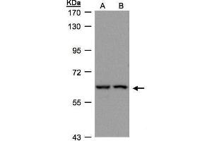 WB Image Sample(30 ug whole cell lysate) A:H1299 B:HeLa S3, 7. (FRS2 Antikörper  (Center))