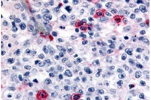 Anti-HRH4 / Histamine H4 Receptor antibody  ABIN1048966 IHC staining of human lymph node. (HRH4 Antikörper  (Cytoplasmic Domain))