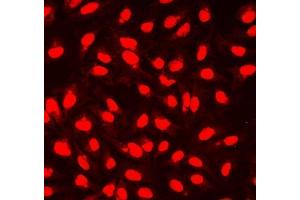 IF analysis of NHEJ1 using anti-NHEJ1 antibody (ABIN7599198).