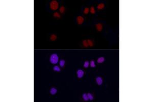 Immunofluorescence analysis of NCI-H460 using Brachyury Rabbit mAb (ABIN1682626, ABIN3019362, ABIN3019363 and ABIN7101757) at dilution of 1:100 (40x lens). (Scinderin Antikörper)