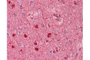 Anti-DCX / Doublecortin antibody IHC staining of human brain, cortex. (Doublecortin Antikörper)