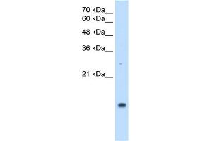 WB Suggested Anti-PPIA Antibody Titration:  2. (PPIA Antikörper  (Middle Region))
