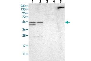 Western blot analysis of Lane 1: RT-4, Lane 2: U-251 MG, Lane 3: Human Plasma, Lane 4: Liver, Lane 5: Tonsil with NDRG3 polyclonal antibody  at 1:250-1:500 dilution. (NDRG3 Antikörper)