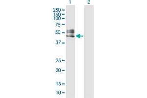 Western Blot analysis of RTN4R expression in transfected 293T cell line by RTN4R MaxPab polyclonal antibody. (RTN4R Antikörper  (AA 1-473))