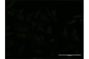 Immunofluorescence of monoclonal antibody to USP9X on HeLa cell. (USP9X Antikörper  (AA 1-90))
