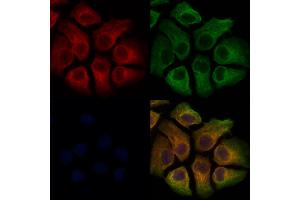 ABIN7093796 and ABIN7097839 staining Hela cells by IF/ICC. (TREM2 Antikörper  (C-Term))