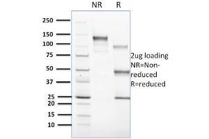 SDS-PAGE Analysis Purified CD1c Mouse Monoclonal Antibody (CD1C/1603). (CD1c Antikörper)