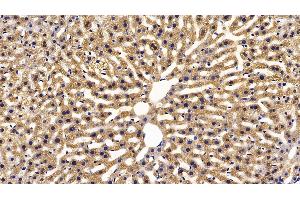 Immunohistochemistry (IHC) image for anti-Fatty Acid Binding Protein 1, Liver (FABP1) (AA 2-127) antibody (ABIN7433792)
