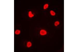 Immunofluorescent analysis of DNA-PKcs staining in MCF7 cells. (PRKDC Antikörper  (C-Term))