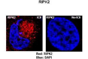 Sample Type :  Rat thyrocytes-FRTL-5   Primary Antibody Dilution :   1:100   Secondary Antibody :  Anti-rabbit-Texas Red   Secondary Antibody Dilution :   1:100   Color/Signal Descriptions :  Red: RIPK2 Blue: DAPI  Gene Name :  RIPK2  Submitted by :  Syed A Morshed, Mount Sinai School of Medicine and James J Peters VA Medical Center (RIPK2 Antikörper  (Middle Region))