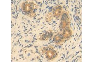 Used in DAB staining on fromalin fixed paraffin- embedded Kidney tissue (GDF9 Antikörper  (AA 306-440))