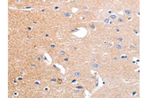 The image on the left is immunohistochemistry of paraffin-embedded Human brain tissue using ABIN7191180(KCNH3 Antibody) at dilution 1/12, on the right is treated with synthetic peptide. (KCNH3 Antikörper)