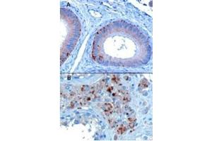 Image no. 1 for anti-Vacuolar Protein Sorting 35 (VPS35) (C-Term) antibody (ABIN374403) (VPS35 Antikörper  (C-Term))