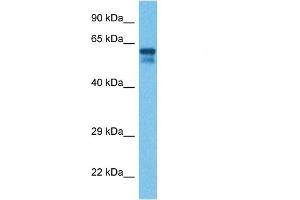 Western Blotting (WB) image for anti-Colony Stimulating Factor 1 (Macrophage) (CSF1) (Middle Region) antibody (ABIN2781824)
