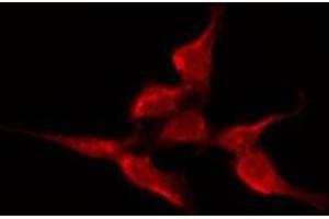 ABIN6275679 staining A549 by IF/ICC. (CACNA1H Antikörper  (Internal Region))