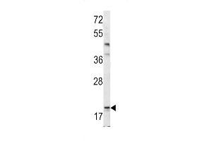 Western blot analysis of Bad BH3 Domain antibody (ABIN388118 and ABIN2846287) in mouse bladder tissue lysates (35 μg/lane). (BAD Antikörper  (AA 92-127))