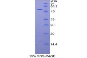 SDS-PAGE (SDS) image for Peroxiredoxin 6 (PRDX6) (AA 1-224) protein (His tag,GST tag) (ABIN1821750)