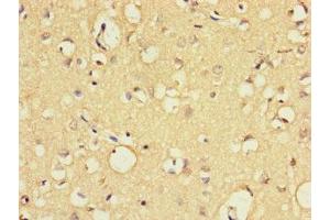 Immunohistochemistry of paraffin-embedded human brain tissue using ABIN7152265 at dilution of 1:100 (Exonuclease 1 Antikörper  (AA 301-600))