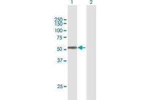 Western Blot analysis of SPOCK2 expression in transfected 293T cell line by SPOCK2 MaxPab polyclonal antibody. (SPOCK2/Testican 2 Antikörper  (AA 1-424))