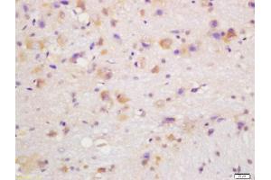 Immunohistochemistry (Paraffin-embedded Sections) (IHC (p)) image for anti-Cytochrome P450, Family 24, Subfamily A, Polypeptide 1 (CYP24A1) (AA 351-450) antibody (ABIN750838)