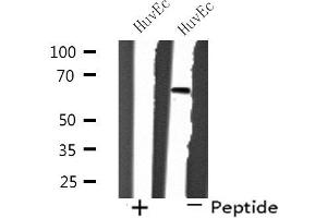 Western blot analysis of extracts from HuvEc cells, using SH2B2 antibody. (SH2B2 Antikörper  (N-Term))